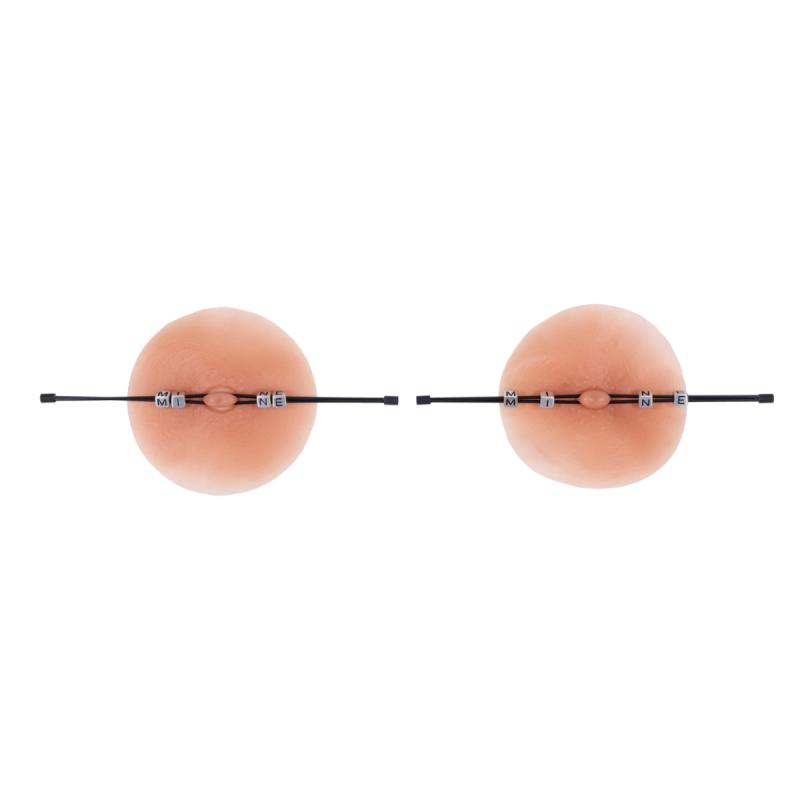 Sportsheets  Edge Pinching Rods - Zwart