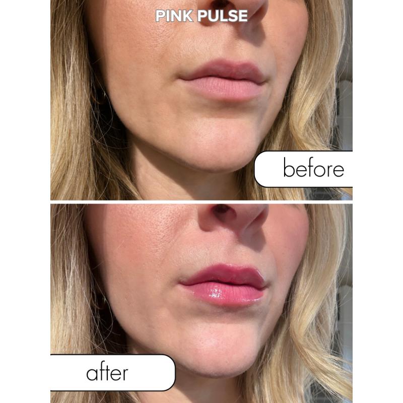 - Matchmaker Kiss Chemistry Lip Gloss - Pink Pulse 3