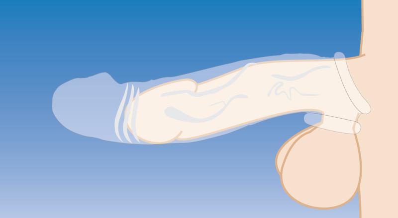 Gaine à penis courbé transparent pour extension de pénis 5