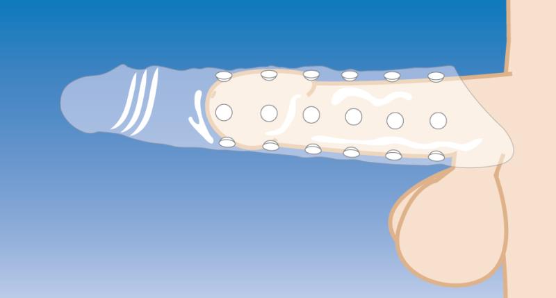 Manchon extenseur pour pénis avec nœuds - Peau claire 5